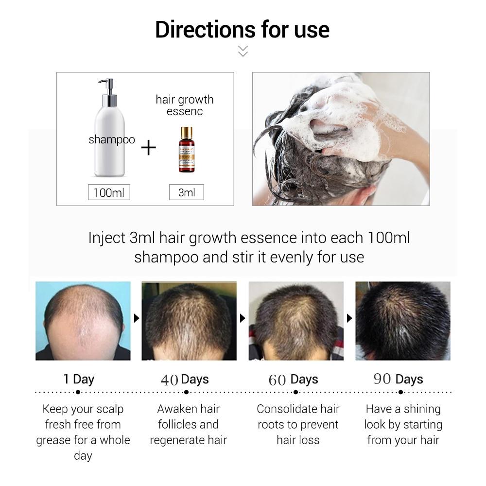 Essence de soins capillaires au gingembre